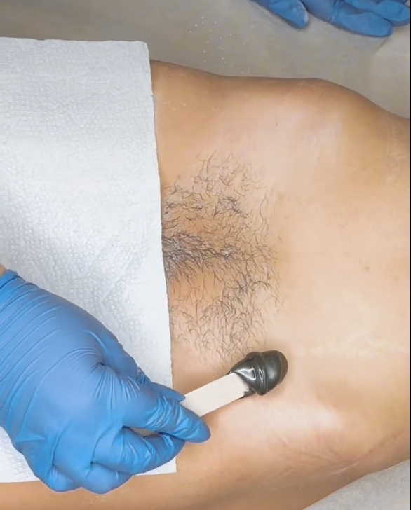 Brazilian Wax Aftercare