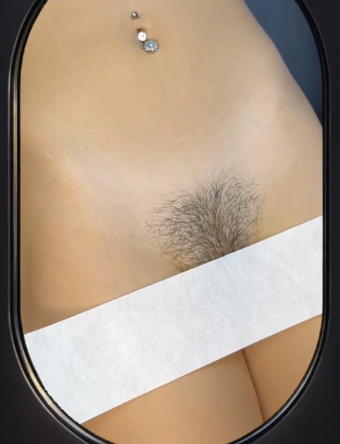how to lighten bikini area