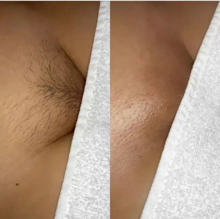 what is a brazilian wax
